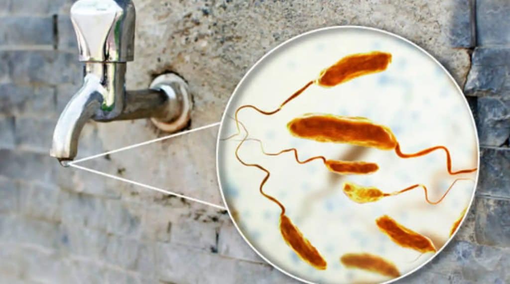 Detectan el primer caso de cólera en España desde 1979