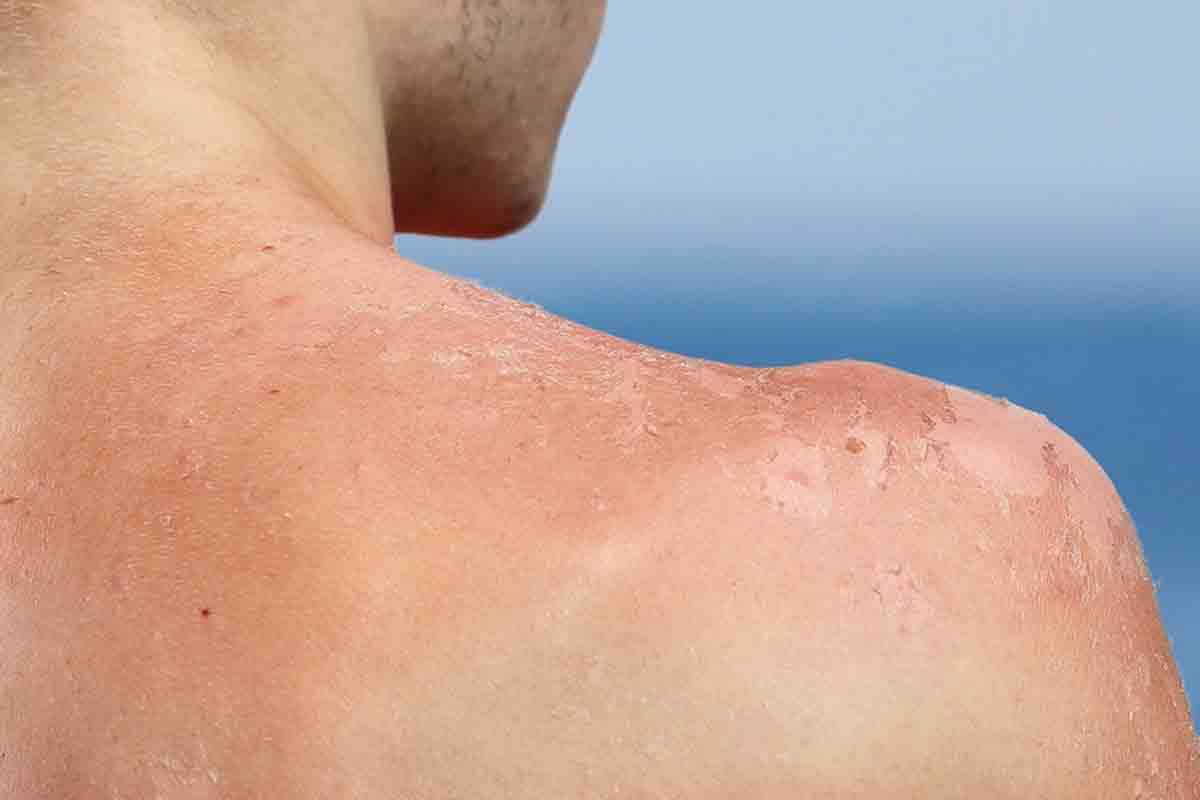 Alertas Canarias calor rayos ultravioleta
