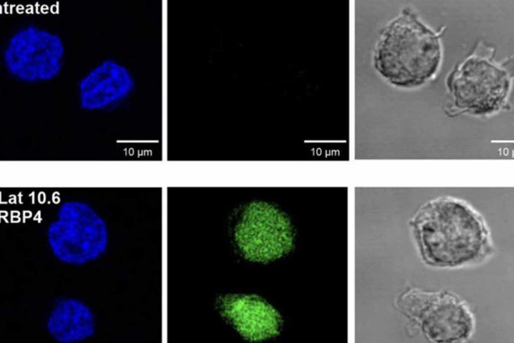 Un estudio analiza el papel de una vitamina en la investigación sobre el VIH